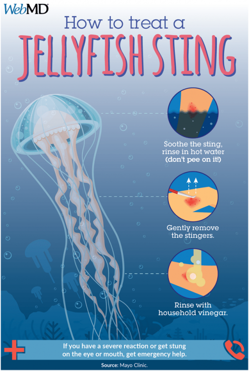 Jellyfish types most commonly found in waters around the UK.